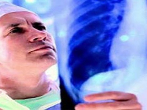 Названі способи виявлення туберкульозу на ранній стадії