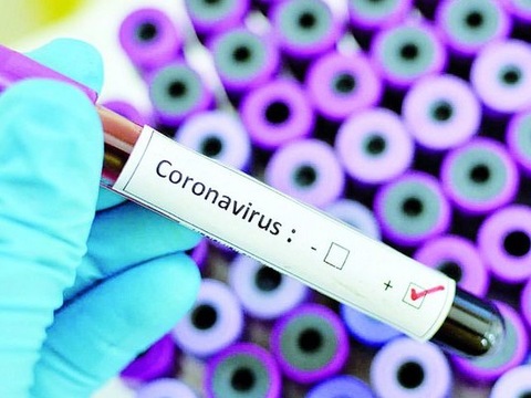 У Німеччині хочуть скасувати всі масові заходи через COVID-19